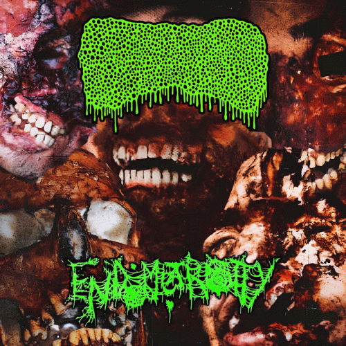 Endometriosity : Lymphoedema / Endometriosity